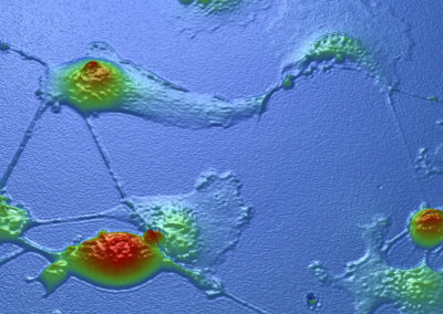 Live Cell Interferometer